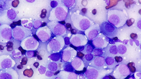 La infección implica la transferencia directa de células cancerosas del tumor venéreo (como en la imagen) entre perros por contacto físico. / Mayra Martinez-Lopez & Julio Ortiz