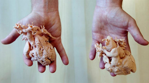 Dos corazones impresos a tamaño real en 3D para planificar su intervención en niños. EFE/Jorge Zapata