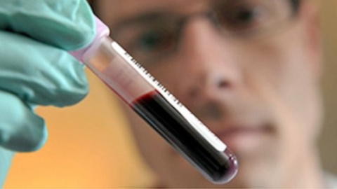 Un profesional sanitario inspeccionando una muestra de análisis de sangre. EFE Un profesional sanitario inspeccionando una muestra de análisis de sangre. EFE