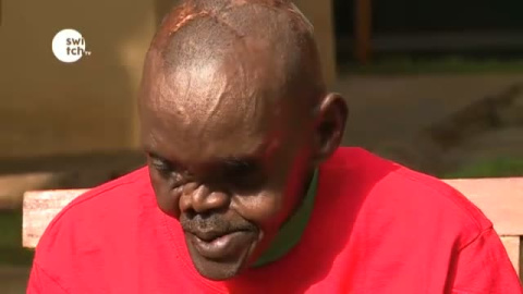 Nuevo 'milagro' del doctor Cavadas: reconstruye el rostro y la mano de un keniano atacado por una hiena Nuevo 'milagro' del doctor Cavadas: reconstruye el rostro y la mano de un keniano atacado por una hiena