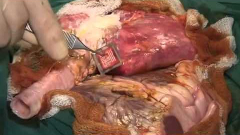 2Btyj9av6EA 2Btyj9av6EA