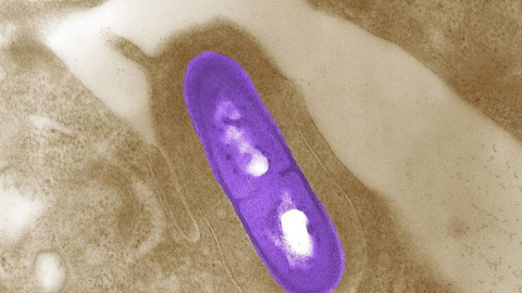 Imagen microscópica de una bacteria Listeria monocytogenes | Reuters Imagen microscópica de una bacteria Listeria monocytogenes | Reuters