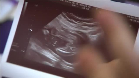 La listeriosis provoca tres nuevos abortos en las últimas horas La listeriosis provoca tres nuevos abortos en las últimas horas