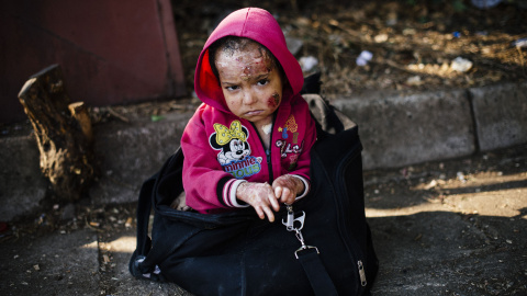 Una niña siria herida por un ataque químico, según su padre, espera el tren con dirección a la frontera con Serbia en la estación de tren en Gevgelija, el 4 de agosto de 2015. AFP PHOTO / DIMITAR DILKOFF