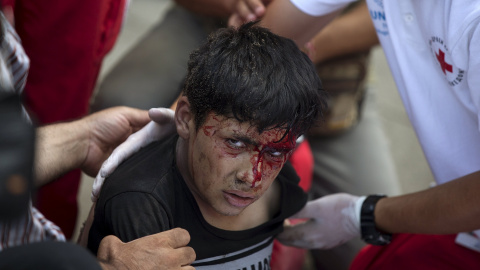 Un migrante menor de edad, sangrando después de recibir una descarga eléctrica al tratar de escalar un poste de electricidad, en la estación de tren de Gevgelija en Macedonia, cerca de la frontera con Grecia.- REUTERS / Stoyan Nenov