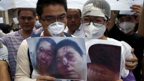 Dos manifestantes muestran una fotografía donde se ven las heridas que sufrieron tras la explosión. REUTERS