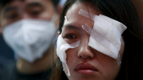 Una asistente a la manifestación de este lunes, que aún lleva vendada la cara por los daños ocasionados por la explosión. REUTERS