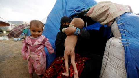 Una mujer sostiene a su bebé desnutrido, al lado de su casa: una tienda de campaña en un campamento para desplazados internos cerca de Sanaa, Yemen. REUTERS / Khaled Abdullah