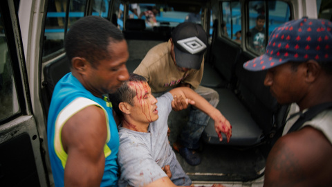 Un refugiado herido en el centro de detención de la Isla de Manus es llevado en brazos tras ser herido en un ataque de un grupo de hombres de Papúa Nueva Guinea. REUTERS Un refugiado herido en el centro de detención de la Isla de Manus es llevado en brazos tras ser herido en un ataque de un grupo de hombres de Papúa Nueva Guinea. REUTERS