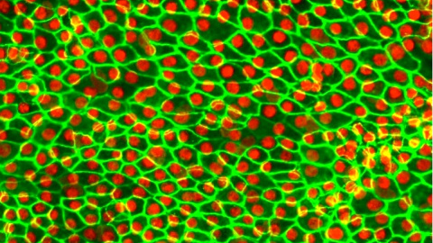 Células de la retina derivadas de células madre para su implantación. El perímetro de cada célula en verde y el núcleo en rojo. DENNIS CLEGG, UCSB