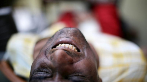 Un hombre reacciona a su tratamiento en "Nirmal Hriday", el hogar y la clínica de la Madre Teresa en Calcuta, India. EFE/Piyal Adhikary