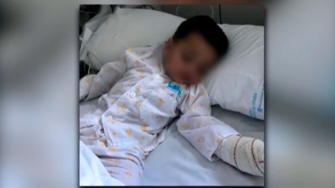 El niños atacado por el perro, en su cama del hospital.- CAPTURA El niños atacado por el perro, en su cama del hospital.- CAPTURA