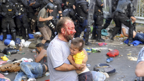 Un migrante herido sostiene a un niño durante los disturbios con la policía húngara en la frontera con Serbia. REUTERS Un migrante herido sostiene a un niño durante los disturbios con la policía húngara en la frontera con Serbia. REUTERS