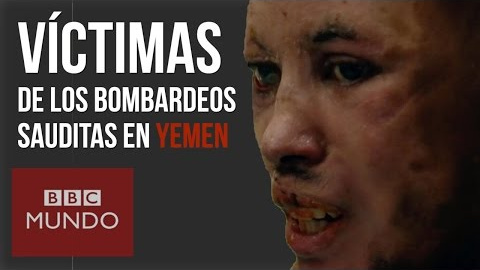 Yemen: un infierno bajo las bombas Yemen: un infierno bajo las bombas