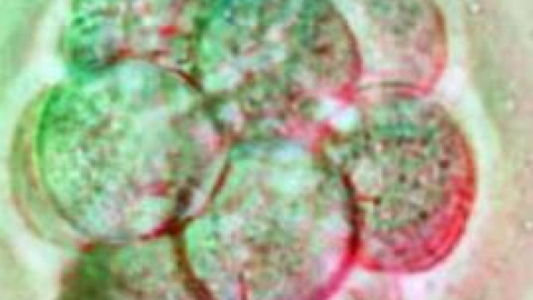 54a16fc8c9923.jpg 54a16fc8c9923.jpg