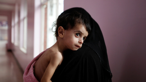Una mujer sostiene a su niño desnutrido en la unidad de cuidados intensivos de un hospital en Sanaa. REUTERS / Khaled Abdullah