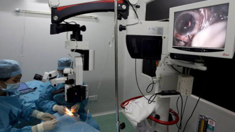 Foto de archivo de una operación de cataratas en un hospital. / EFE Foto de archivo de una operación de cataratas en un hospital. / EFE