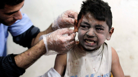 Un niño herido recibe asistencia médica en un hospital de campaña. El pequeño resultó herido en lo que los activistas dijeron que eran ataques aéreos de las fuerzas leales a Al-Assad, en Siria. / MOHAMMED BADRA (REUTERS)