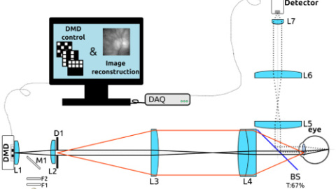 Unas lentes permitirán ver a personas con cataratas sin necesidad de una intervención quirúrgica Unas lentes permitirán ver a personas con cataratas sin necesidad de una intervención quirúrgica