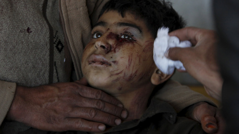 Un niño herido en el terremoto es atendido en el hospital Lady Reading en Peshawar, Pakistán./ REUTERS/Fayaz Aziz