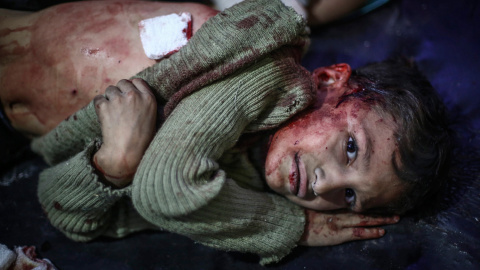 Un niño sirio recibe atención médica tras un ataque de las fuerzas del régimen sirio en Duma, a las afueras de Damasco (Siria). Al menos 40 personas murieron y unas cien resultaron heridas en el ataque.-EFE/Mohammed Badra