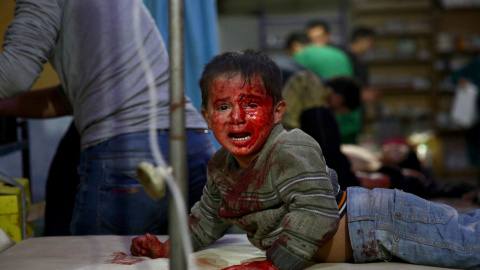 Un niño sirio recibe atención médica tras un ataque de las fuerzas del régimen sirio en Duma, a las afueras de Damasco (Siria) hoy, 30 de octubre de 2015. Al menos 40 personas murieron hoy y unas cien resultaron heridas en el ataque en Duma