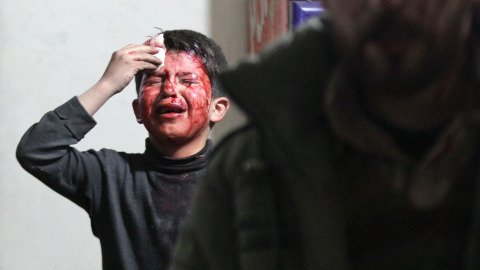 Niño herido en Siria. REUTERS