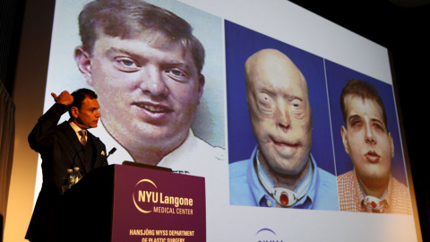 El doctor Eduardo Rodríguez presenta los resultados del trasplante. REUTERS/Mike Segar El doctor Eduardo Rodríguez presenta los resultados del trasplante. REUTERS/Mike Segar