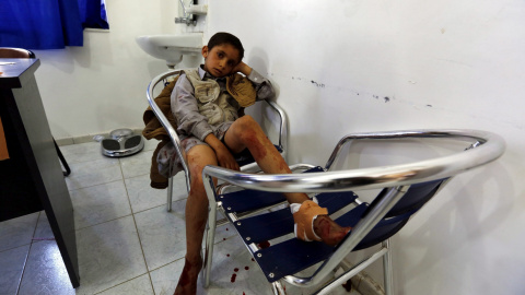 Un joven yemení que resultó herido en el ataque contra una mezquita chií en Saná (Yemen). EFE/YAHYA ARHAB Un joven yemení que resultó herido en el ataque contra una mezquita chií en Saná (Yemen). EFE/YAHYA ARHAB