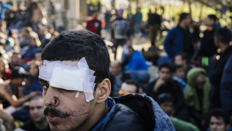 Un hombre herido se encuentra con otros inmigrantes procedentes de  Marruecos, Pakistán, Sri Lanka y Sudán sentados para bloquear las vías del tren cerca de Gevgelija en la frontera entre Grecia y Macedonia el 19 de noviembre de 2015. AFP /