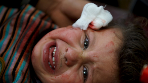 Un niño herido llora dentro de un hospital después de unos ataques aéreos que según los activistas de la zona eran de las fuerzas leales al presidente Bashar al-Assad. Los ataques se produjeron en la ciudad de Abtaa, Deraa, Siria 30 de dici