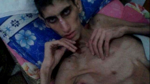 Una fotografía sin fecha tomada en Madaya y distribuida por las redes sociales. REUTERS Una fotografía sin fecha tomada en Madaya y distribuida por las redes sociales. REUTERS