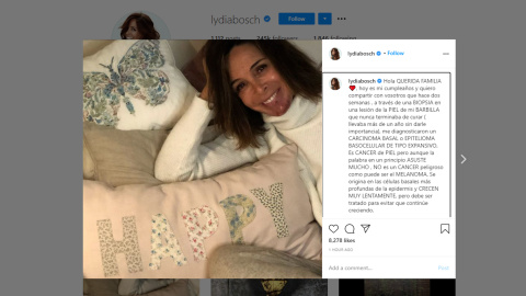 Lydia Bosch confiesa que tiene cáncer de piel Lydia Bosch confiesa que tiene cáncer de piel