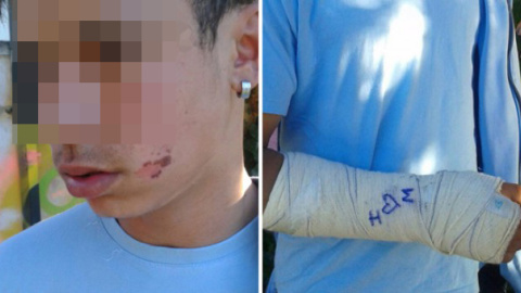 Imagen de un menor extranjero no acompañado, mostrada durante el pleno de la Asamblea de Madrid por la diputada Isabel Serra para denunciar malos tratos en un centro de primera acogida de la Comunidad de Madrid en Hortaleza.- PODEMOS Imagen de un menor extranjero no acompañado, mostrada durante el pleno de la Asamblea de Madrid por la diputada Isabel Serra para denunciar malos tratos en un centro de primera acogida de la Comunidad de Madrid en Hortaleza.- PODEMOS