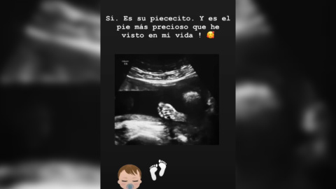 Lorena Gómez comparte con sus seguidores la ecografía de su bebé Lorena Gómez comparte con sus seguidores la ecografía de su bebé