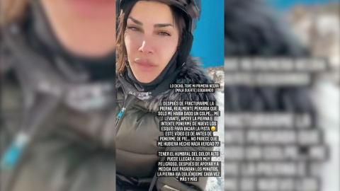 Carla Barber comparte imágenes de su operación tras fracturarse la tibia Carla Barber comparte imágenes de su operación tras fracturarse la tibia