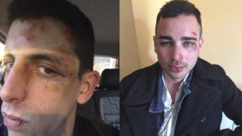 Joves agredits a Berga Joves agredits a Berga