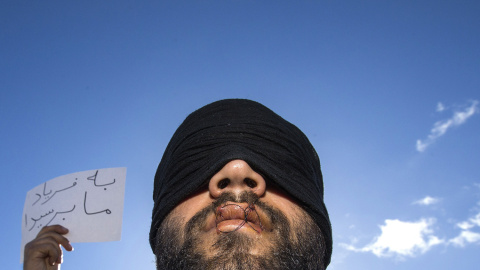 Un cartel dice "¿Por qué no nos escuchan" se ve detrás de un migrante de Irán en huelga de hambre con los labios cerrados cosidos, durante el desmantelamiento de una ciudad de chabolas en Calais, Francia. REUTERS/Yves Herman