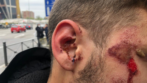 Momento de la detención de un joven en Vallecas durante la protesta contra el acto de la ultraderecha Momento de la detención de un joven en Vallecas durante la protesta contra el acto de la ultraderecha