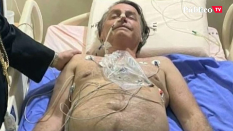 Bolsonaro, hospitalizado por fuertes dolores abdominales Bolsonaro, hospitalizado por fuertes dolores abdominales