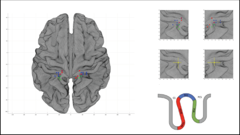 Variabilidad interindividual de la corteza somatosensorial genital. Variabilidad interindividual de la corteza somatosensorial genital.