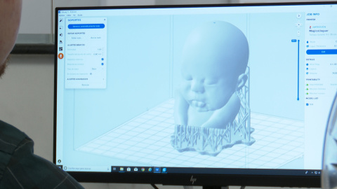 Ecografías en impresión 3D permiten a invidentes conocer a sus bebés Ecografías en impresión 3D permiten a invidentes conocer a sus bebés