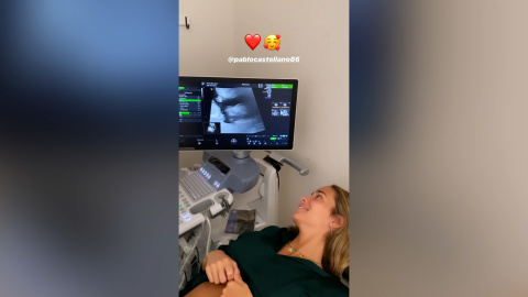 María Pombo se emociona con la primera ecografía del embarazo María Pombo se emociona con la primera ecografía del embarazo