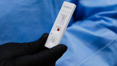 Un test positivo de coronavirus / Efe