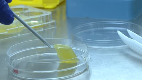 Científicos españoles desarrollan una córnea artificial pionera en Europa, elaborada con sangre y algas Científicos españoles desarrollan una córnea artificial pionera en Europa, elaborada con sangre y algas