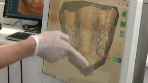 Un 36% de los pacientes han dejado de ir al dentista por motivos económicos Un 36% de los pacientes han dejado de ir al dentista por motivos económicos
