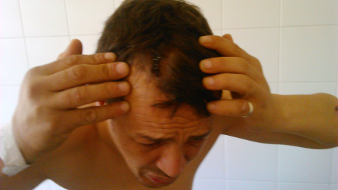 El argelino Mohamed Rezine Zohuir muestra las heridas que presuntamente le causaron en el CIE.