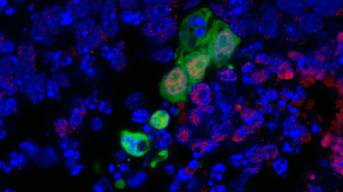 En esta imagen, un nuevo tipo de células madre humanas se muestra en verde e integra el desarrollo en las células circundantes de un embrión de ratón inviable. El color rojo indica células de linaje endodermo. / Salk Institute
