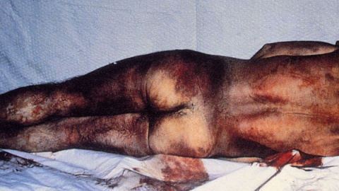 Cuerpo de Joseba Arregi, muerto por torturas.