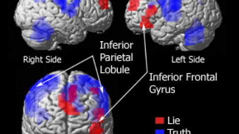 PososAnarquia_Cerebro_Graf